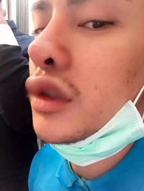 泰国整容网红男生,从平凡到瞩目的整容蜕变之旅