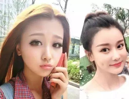 整容都像网红,整容潮流下的美丽标准